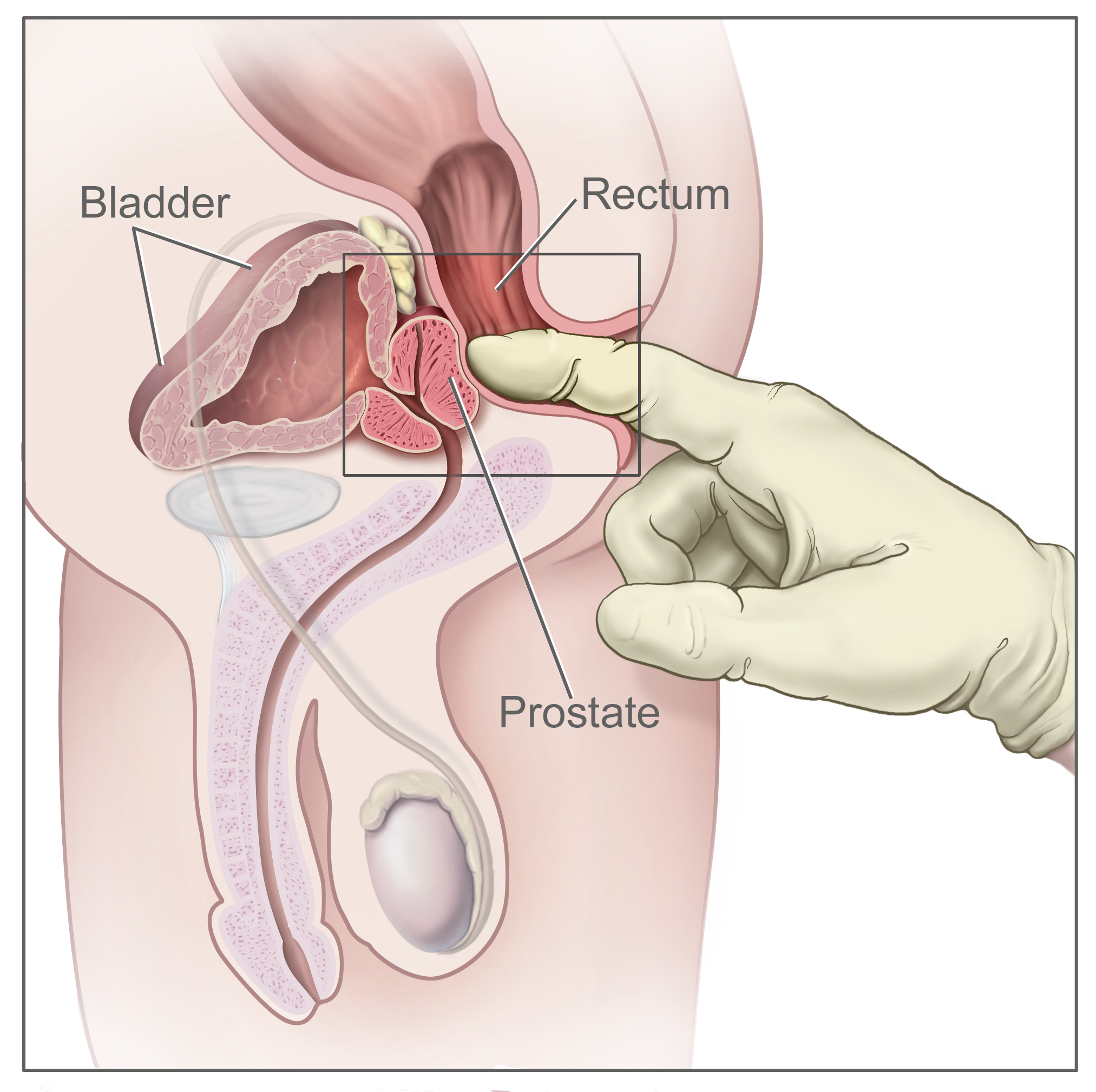 Prostate Rectal Exam